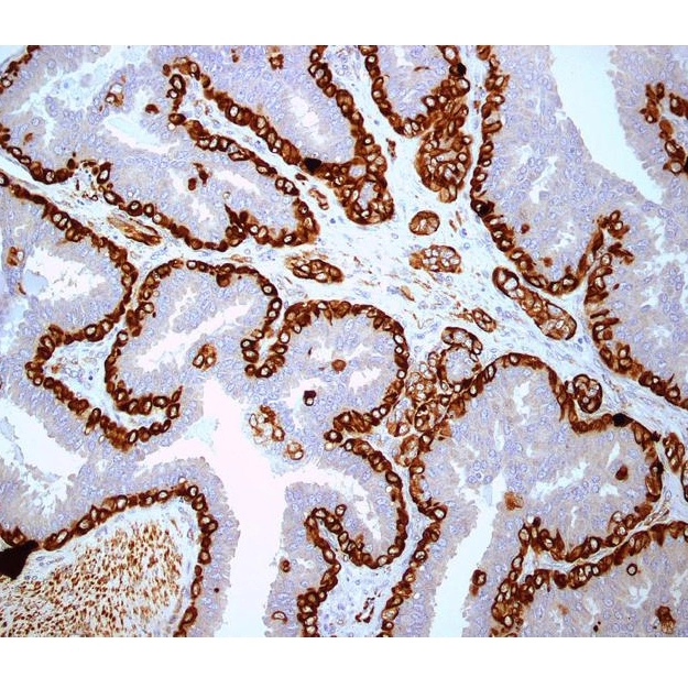 Immunohistochemistry laboratory staining and analysis