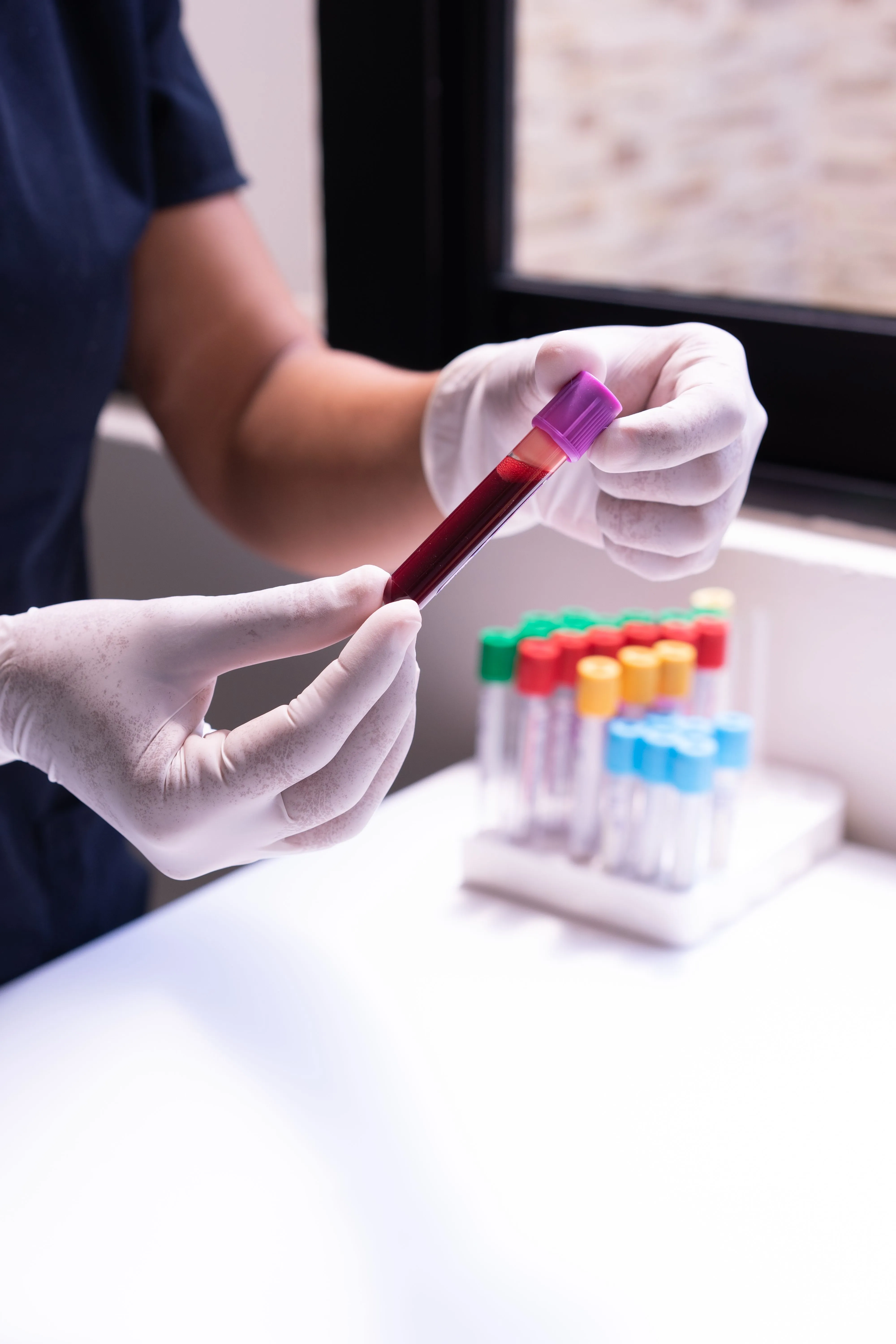 Immune Monitoring & Flow Cytometry