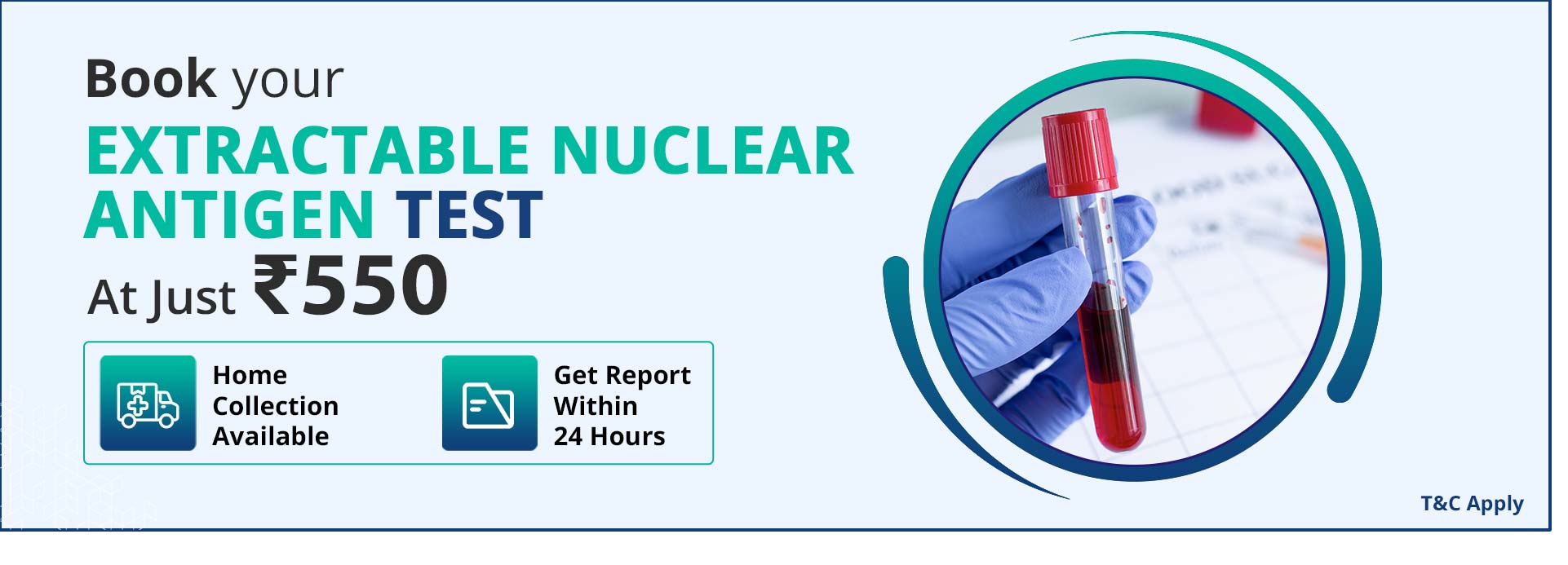 Extractable nuclear antigen test