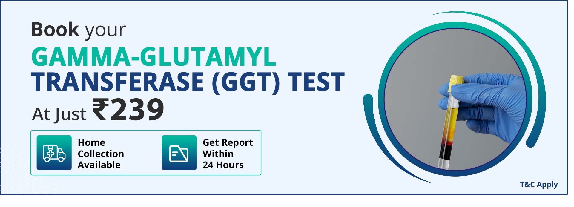 Gamma glutamyl transferase test