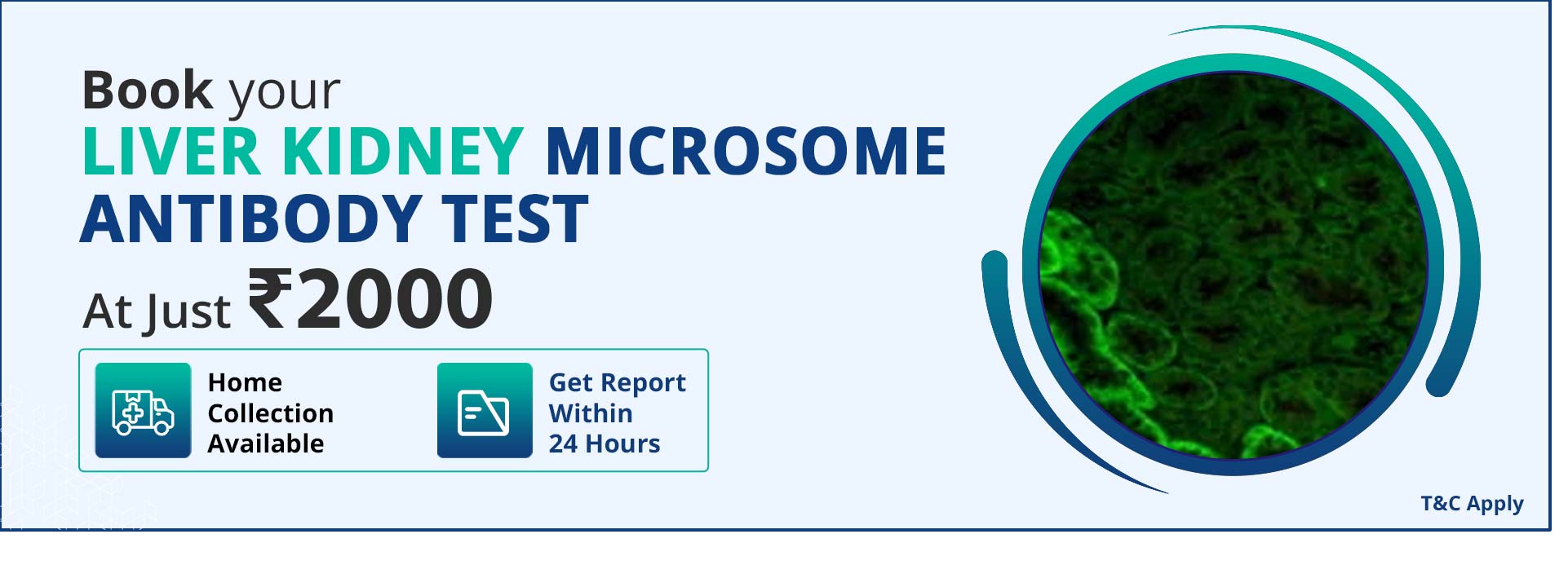 Liver kidney microsome antibody test