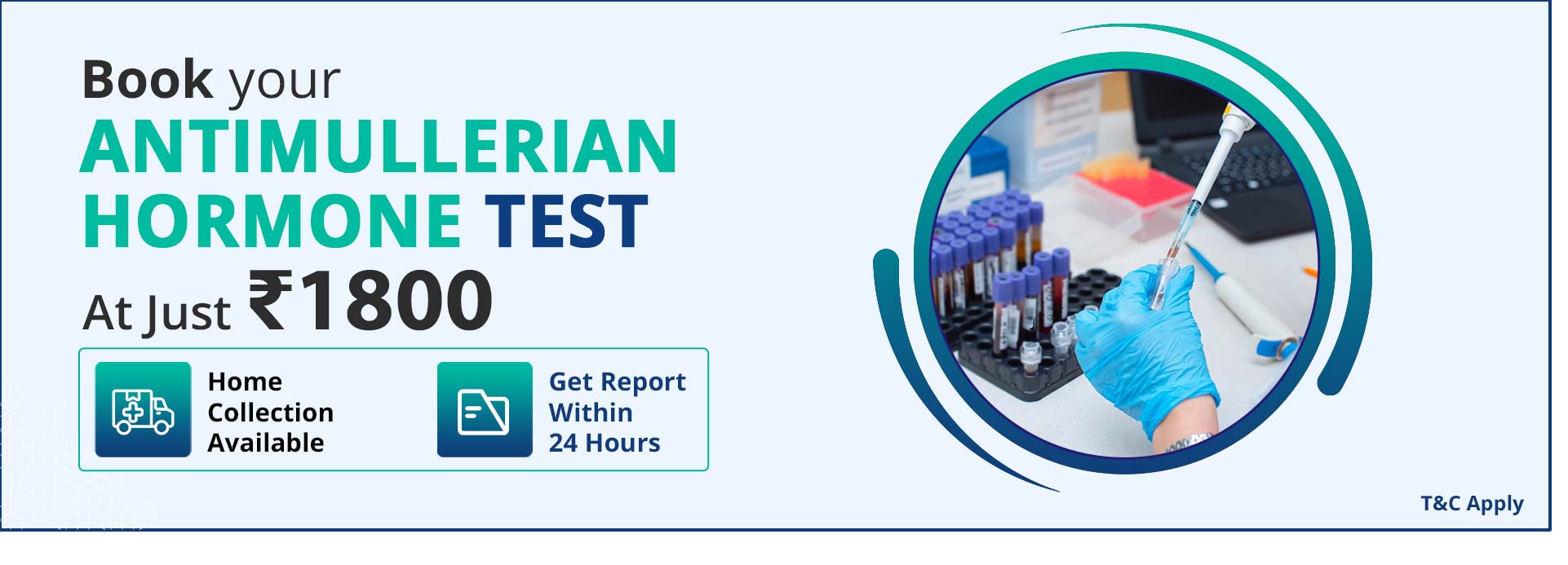 Antimullerian Hormone Test