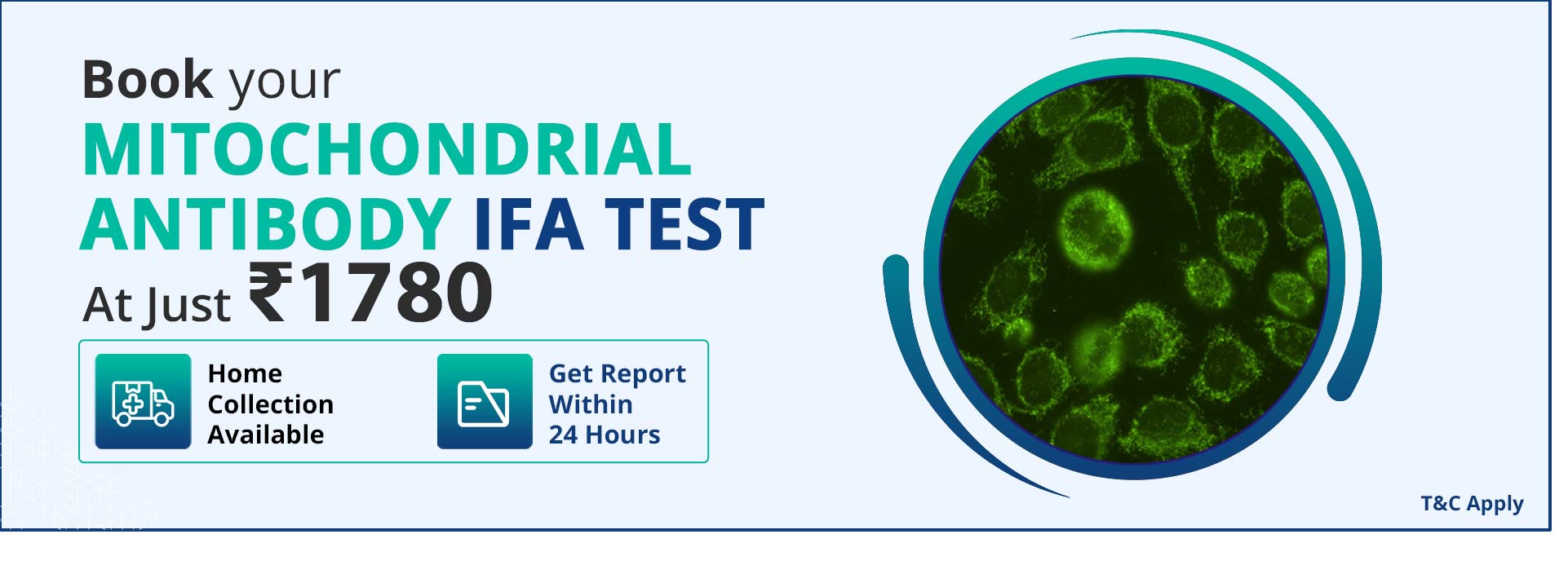 Mitochondrial Antibody IFA Test