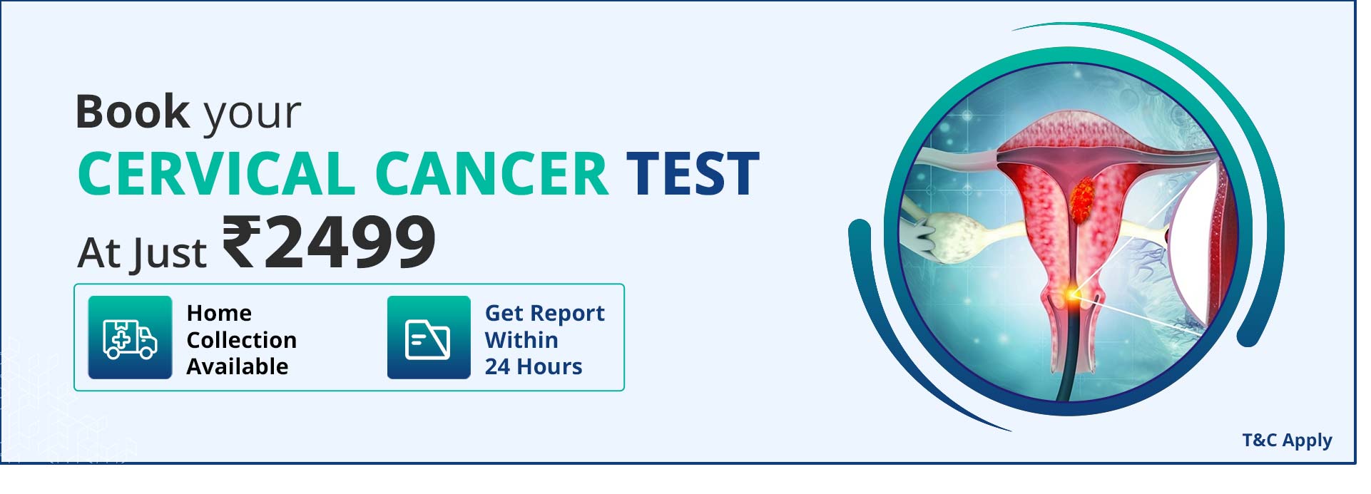 Cervical Cancer Test