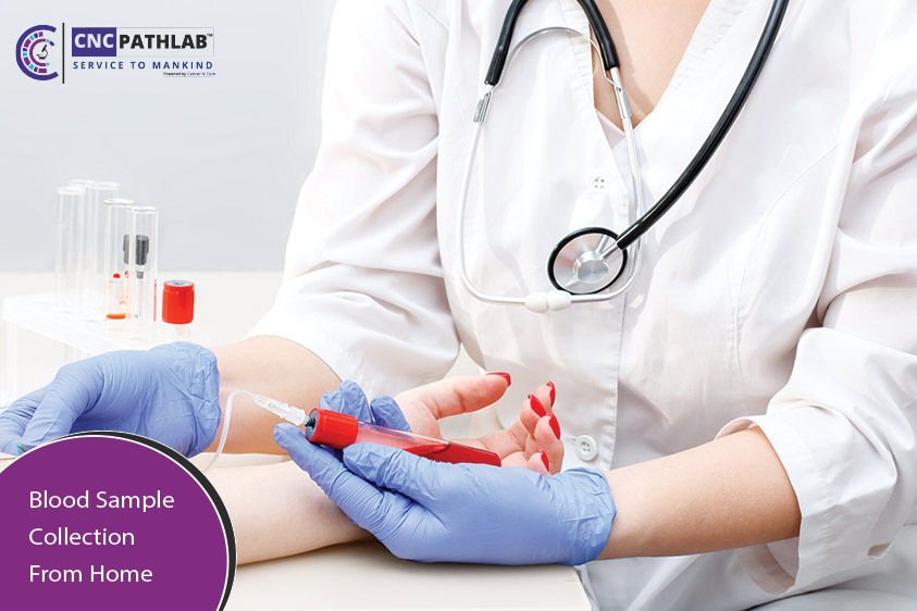 Stay Safe and Healthy with Blood Test Home Collection Options in Delhi