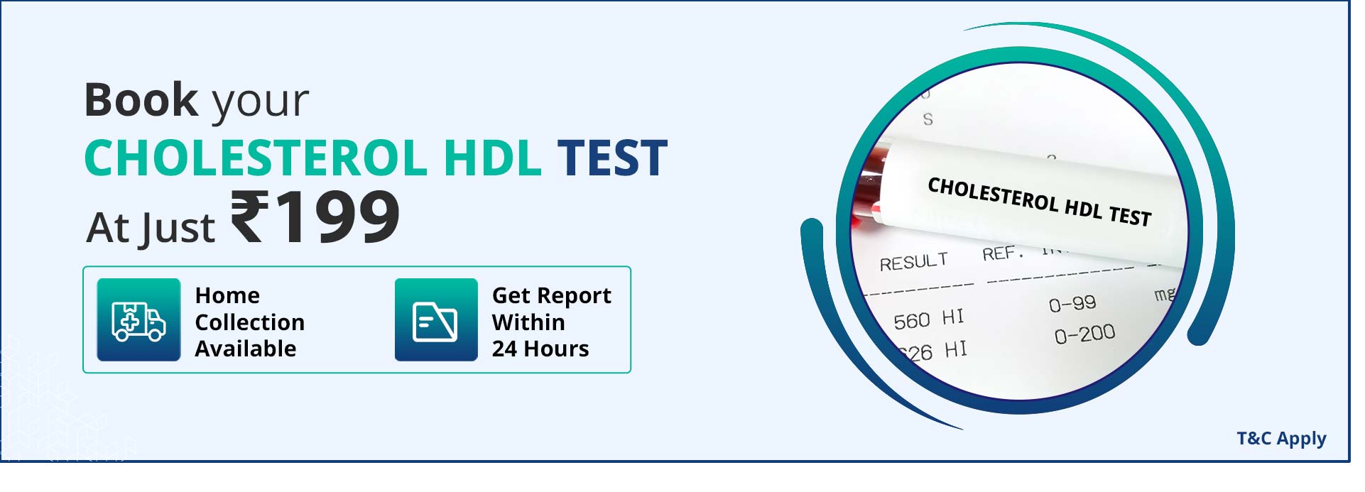 Cholesterol HDL Test