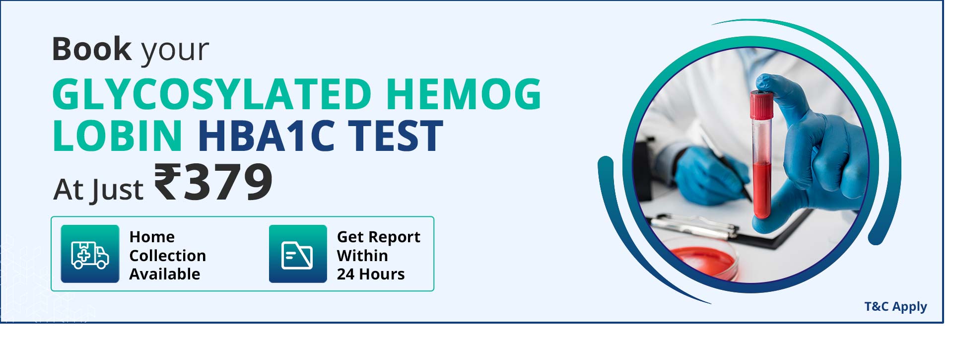 Glycosylated Hemoglobin HbA1c Test