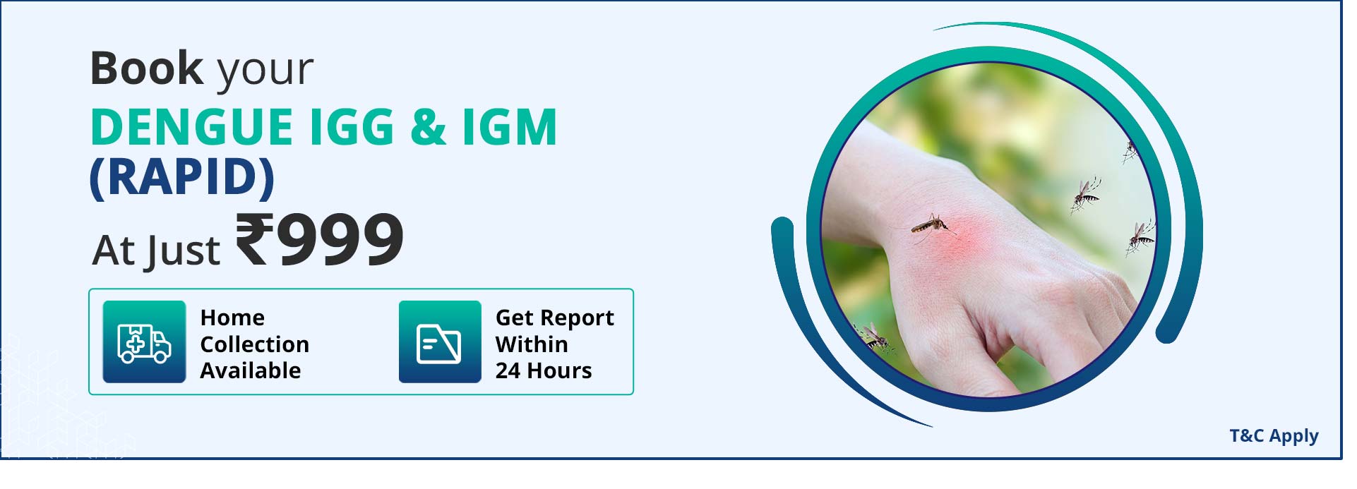Dengue IGG & IGM (Rapid)