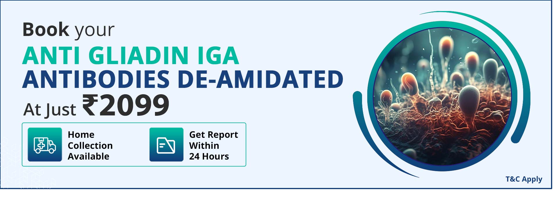 Anti Gliadin IgA Antibodies De-amidated