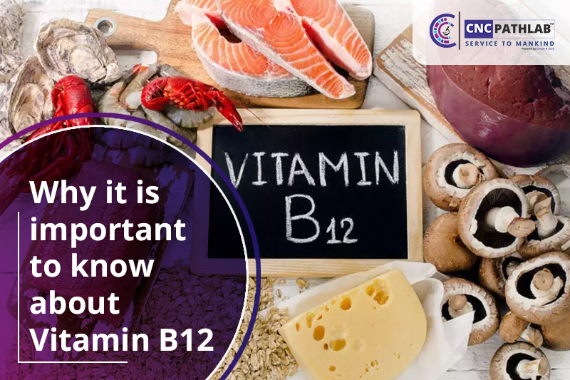 Why it is important to know about Vitamin B12