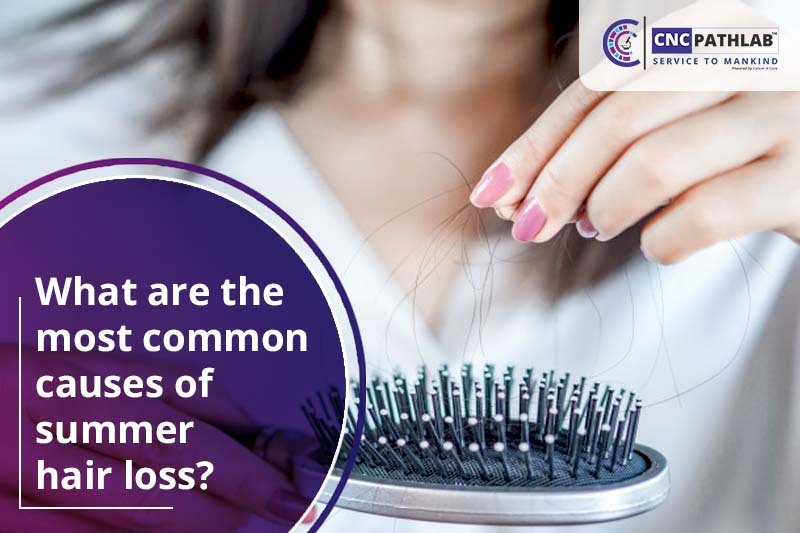 What are the most common causes of summer hair loss?