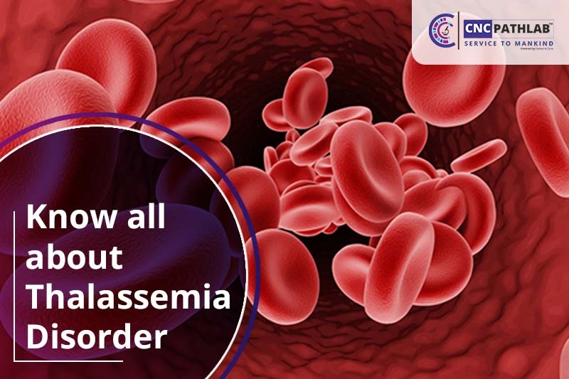 Know all about Thalassemia Disorder