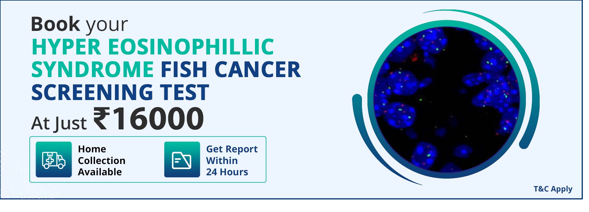 Hyper Eosinophillic Syndrome Fish Cancer Screening Test