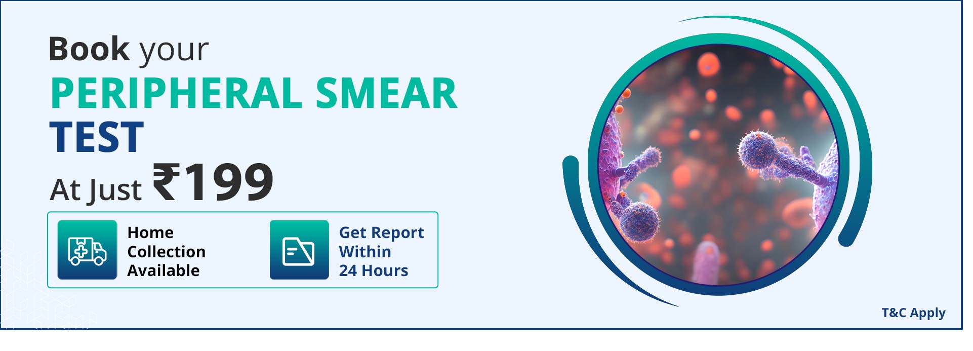 Peripheral smear Test